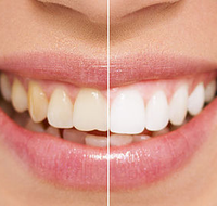 All About Smiles Kincumber - Dentist in Melbourne