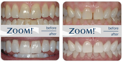 Arthur Street Dental - Dentist in Melbourne 7
