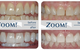 Arthur Street Dental - thumb 12