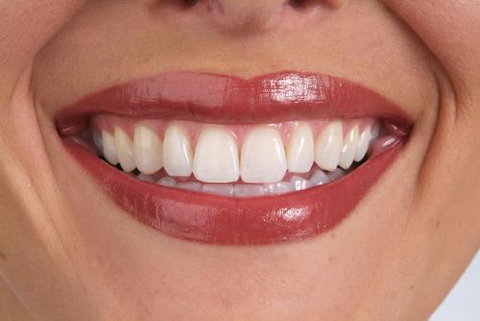 It's Your Smile - Dentist in Melbourne 5