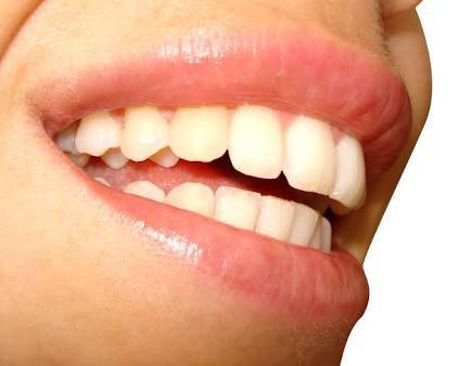Affordable Dental Care - Dentist in Melbourne 20