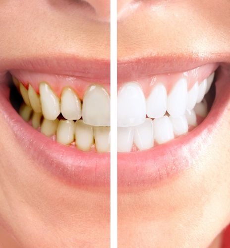 Graham Johnson Dental Surgeon - Dentist in Melbourne 15