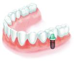 Sunrise Dental - Dentist in Melbourne 5