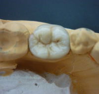 M A Dental Ceramics - Dentist in Melbourne