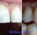 Rien Dental - Dentist in Melbourne