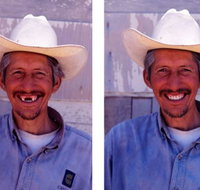 Denture Mt Gravatt - Dentist in Melbourne