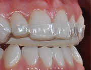 Hermitage Dental - Dentist in Melbourne 4