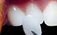 Hermitage Dental - thumb 6