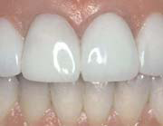 Hermitage Dental - Dentist in Melbourne 7