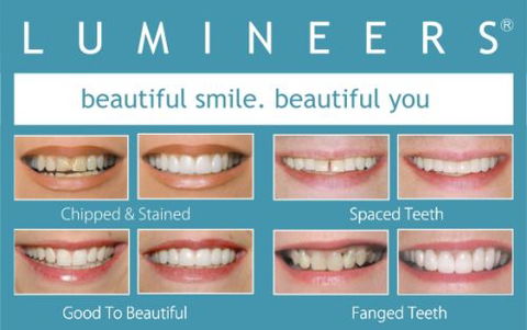 CUMULUS DENTAL - Dentist in Melbourne 6