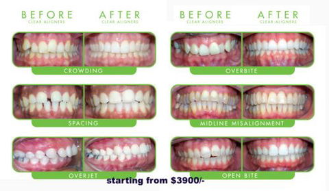 CUMULUS DENTAL - Dentist in Melbourne 7