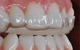 Hermitage Dental - thumb 9