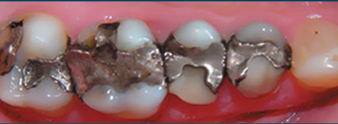Sundial Dental - Dentist in Melbourne 4