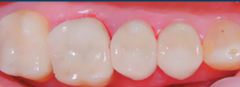 Sundial Dental - Dentist in Melbourne 5