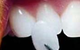 Hermitage Dental - thumb 16
