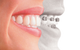 Woolgoolga Dental Centre - thumb 8