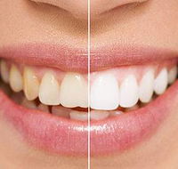 Newcastle Dental Care - Dentist in Melbourne
