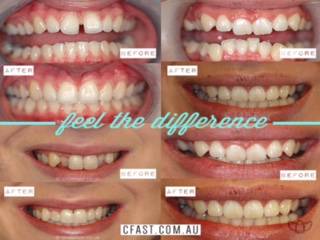 Fresh Dental Care - Dentist in Melbourne 6