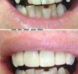 Your Dentist Gunnedah - Dentist in Melbourne