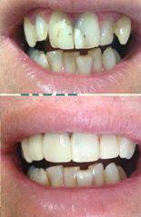 Your Dentist Gunnedah