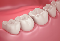 Coastal Dental Implants