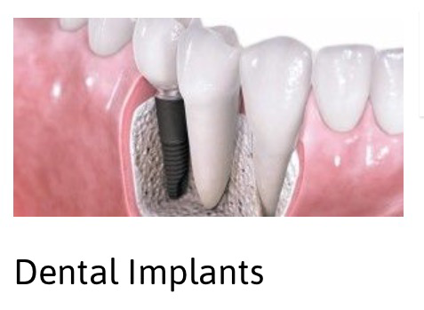 A2Z Dental - Dentist in Melbourne 4