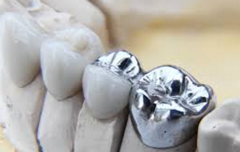 Hervey Bay Dental - Dentist in Melbourne 5