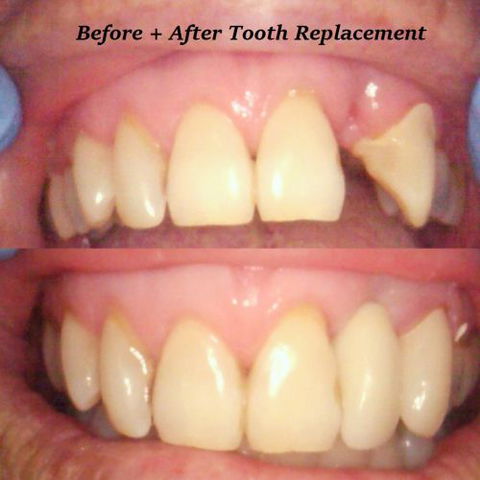 Fraser Shores Family Dental - Dentist in Melbourne 3