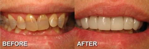 Ooralea Dental Care - Dentist in Melbourne 4