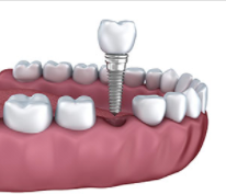 Smiles Nambour - Dentist in Melbourne 3