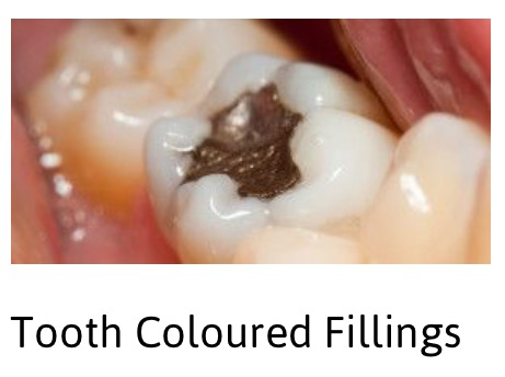 A2Z Dental - Dentist in Melbourne 8